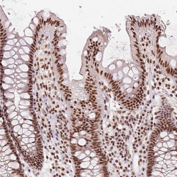 Anti-IK antibody produced in rabbit Prestige Antibodies&#174; Powered by Atlas Antibodies, affinity isolated antibody, buffered aqueous glycerol solution