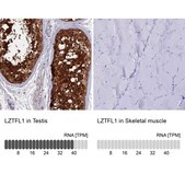 Anti-LZTFL1 antibody produced in rabbit Prestige Antibodies® Powered by Atlas Antibodies, affinity isolated antibody, buffered aqueous glycerol solution