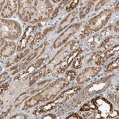 Anti-ARMC1 antibody produced in rabbit Prestige Antibodies® Powered by Atlas Antibodies, affinity isolated antibody, buffered aqueous glycerol solution