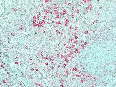 Anti-Rabbit IgG (whole molecule)–Alkaline Phosphatase antibody produced in goat IgG fraction of antiserum