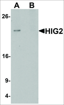 Anti-HIGD2A antibody produced in rabbit affinity isolated antibody