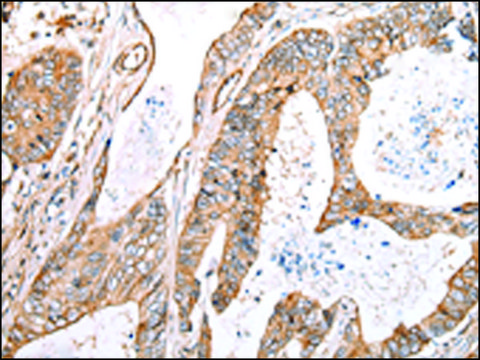 Anti-KCTD16 affinity isolated antibody