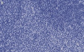 Anti-CD25 (IL2-RA) Antibody, clone 1K6 ZooMAb® Rabbit Monoclonal recombinant, expressed in HEK 293 cells