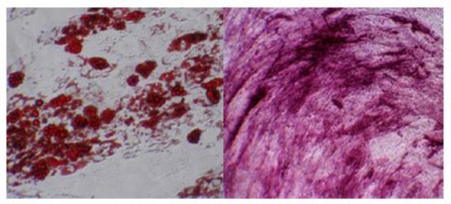 人间充质干细胞（骨髓） Human mesenchymal stem cells derived from bone marrow that have a capacity for expansion in vitro while maintaining their potential for differentiation to multiple lineages including adipocytes, osteoblasts and chondrocytes.