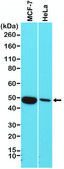 Anti-Cytokeratin 18 antibody, Rabbit monoclonal recombinant, expressed in HEK 293 cells, clone RM279, purified immunoglobulin