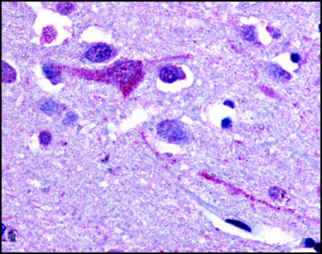 Anti-SLC5A9 (AB1) antibody produced in rabbit affinity isolated antibody, buffered aqueous solution