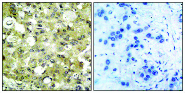 Anti-KDR (Ab-951) antibody produced in rabbit affinity isolated antibody