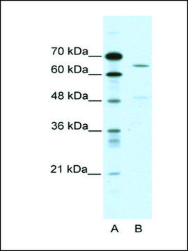 Anti-ACCN1 antibody produced in rabbit affinity isolated antibody