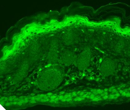 Monoclonal Anti-TRPV3 antibody produced in mouse clone S15-4, 1&#160;mg/mL, purified immunoglobulin