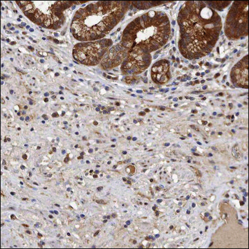 Anti-CTGF antibody produced in rabbit Prestige Antibodies&#174; Powered by Atlas Antibodies, affinity isolated antibody, buffered aqueous glycerol solution, ab1