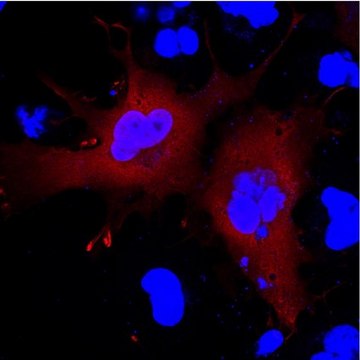 Anti-Serpin B9 Antibody, clone 7D8 clone 7D8, from mouse