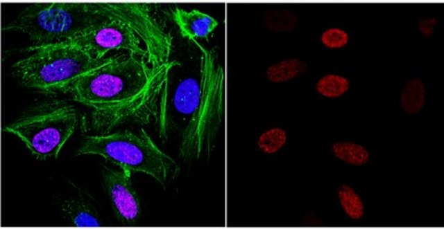 Anti-DNA G-quadruplex (G4) Antibody, clone 1H6 clone 1H6, from mouse