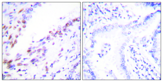 抗-KI67 兔抗 affinity isolated antibody