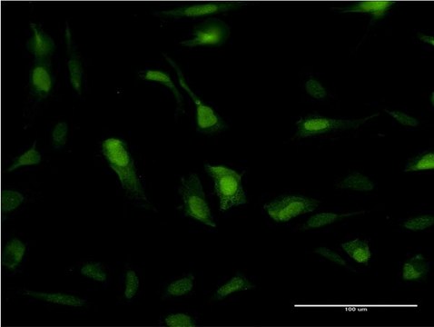 Monoclonal Anti-SOD1 antibody produced in mouse clone 10D5, purified immunoglobulin, buffered aqueous solution