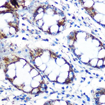 Anti-Peroxiredoxin 3 (PRDX3) antibody produced in rabbit