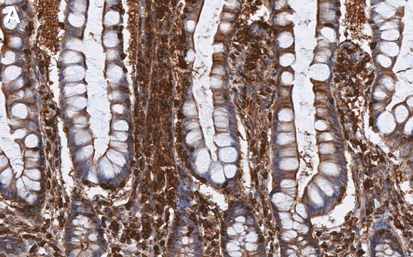 Anti-RIP1/RIPK1 Antibody, clone 1N16 ZooMAb&#174; Rabbit Monoclonal recombinant, expressed in HEK 293 cells