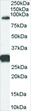 Anti-FOXP2 (Internal) antibody produced in goat affinity isolated antibody, buffered aqueous solution