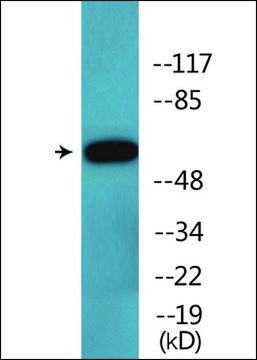 Anti-phospho-Cortactin (pTyr421) antibody produced in rabbit affinity isolated antibody