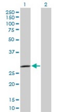 Anti-SPSB2 antibody produced in rabbit purified immunoglobulin, buffered aqueous solution