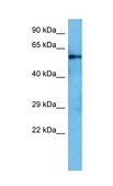 Anti-SMAD5 antibody produced in rabbit affinity isolated antibody