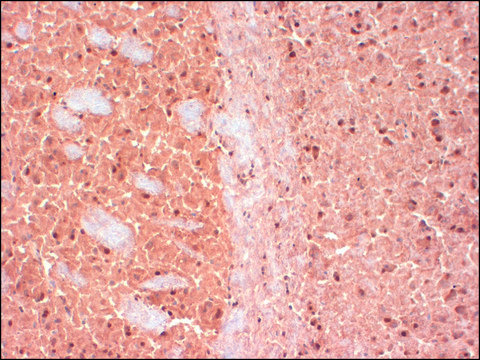 Monoclonal Anti-CASK antibody produced in mouse clone S56A-50, 1&#160;mg/mL, purified immunoglobulin