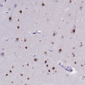 Monoclonal Anti-SATB2 antibody produced in mouse Prestige Antibodies® Powered by Atlas Antibodies, clone CL0319, purified immunoglobulin, buffered aqueous glycerol solution