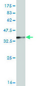 Monoclonal Anti-RTKN antibody produced in mouse clone 2E5, purified immunoglobulin, buffered aqueous solution