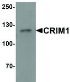 Anti-CRIM1 antibody produced in rabbit affinity isolated antibody, buffered aqueous solution