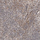 Anti-NCAPG2 antibody produced in rabbit Prestige Antibodies® Powered by Atlas Antibodies, affinity isolated antibody, buffered aqueous glycerol solution