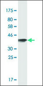 Monoclonal Anti-OSBPL7 antibody produced in mouse clone 3D11, purified immunoglobulin, buffered aqueous solution