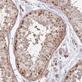 Anti-ST18 antibody produced in rabbit Prestige Antibodies® Powered by Atlas Antibodies, affinity isolated antibody, buffered aqueous glycerol solution