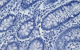 Anti-CD138/Syndecan-1 Antibody, clone 3N22-1 ZooMAb® Rabbit Monoclonal recombinant, expressed in HEK 293 cells