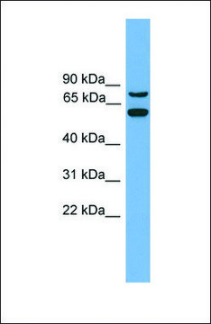 Anti-YY1AP1 antibody produced in rabbit affinity isolated antibody