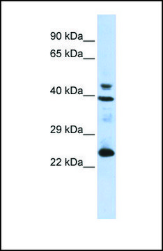 Anti-SEPP1, (N-terminal) antibody produced in rabbit affinity isolated antibody