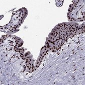 Anti-ARID3A antibody produced in rabbit Prestige Antibodies® Powered by Atlas Antibodies, affinity isolated antibody, buffered aqueous glycerol solution