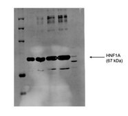 Anti-HNF1A, (N-terminal) antibody produced in rabbit affinity isolated antibody