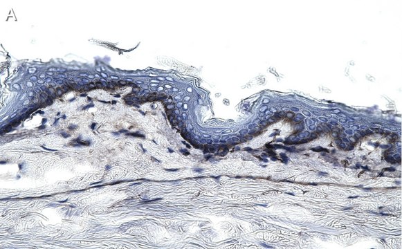 Anti-Collagen Type VII Antibody, clone 1E5 ZooMAb&#174; Rabbit Monoclonal recombinant, expressed in HEK 293 cells