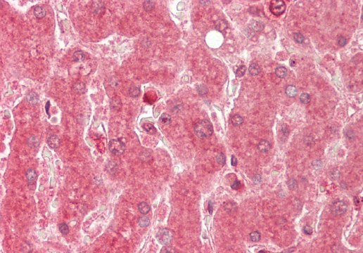 Anti-ALAS1 antibody produced in rabbit affinity isolated antibody