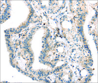 Anti-TBXA2R affinity isolated antibody