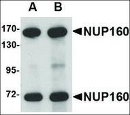 Anti-NUP160 antibody produced in rabbit affinity isolated antibody, buffered aqueous solution