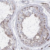 Anti-LCLAT1 antibody produced in rabbit Prestige Antibodies® Powered by Atlas Antibodies, affinity isolated antibody, buffered aqueous glycerol solution