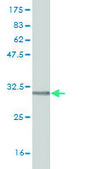 Monoclonal Anti-RCE1 antibody produced in mouse clone 6A6, purified immunoglobulin, buffered aqueous solution