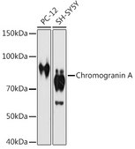 Anti-Chromogranin A Antibody, clone 2N5Q4, Rabbit Monoclonal