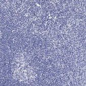 Anti-SCCPDH antibody produced in rabbit Prestige Antibodies® Powered by Atlas Antibodies, affinity isolated antibody, buffered aqueous glycerol solution