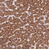 Anti-NADK2 antibody produced in rabbit Prestige Antibodies® Powered by Atlas Antibodies, affinity isolated antibody, buffered aqueous glycerol solution