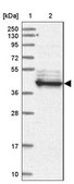 Anti-LRRC2 antibody produced in rabbit Prestige Antibodies® Powered by Atlas Antibodies, affinity isolated antibody, buffered aqueous glycerol solution