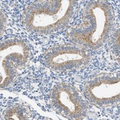 Anti-TOMM34 antibody produced in rabbit Prestige Antibodies® Powered by Atlas Antibodies, affinity isolated antibody, buffered aqueous glycerol solution