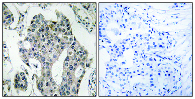 Anti-RAB3GAP2 antibody produced in rabbit affinity isolated antibody