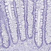 Anti-CGB3 antibody produced in rabbit Prestige Antibodies® Powered by Atlas Antibodies, affinity isolated antibody, buffered aqueous glycerol solution