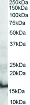 Anti-SH2D1A/SAP antibody produced in goat affinity isolated antibody, buffered aqueous solution